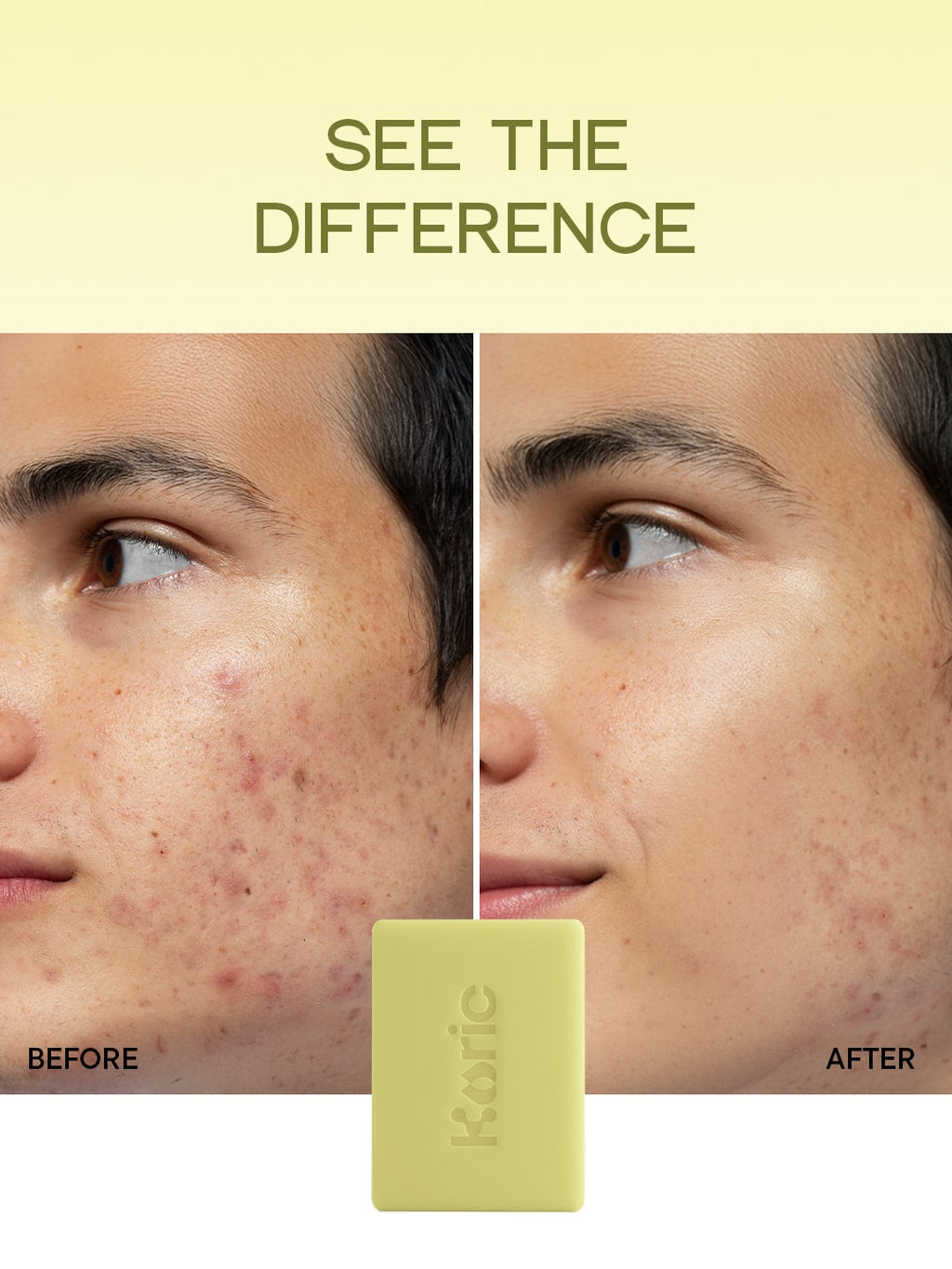 Clarifying + Calming Cleansing Bar