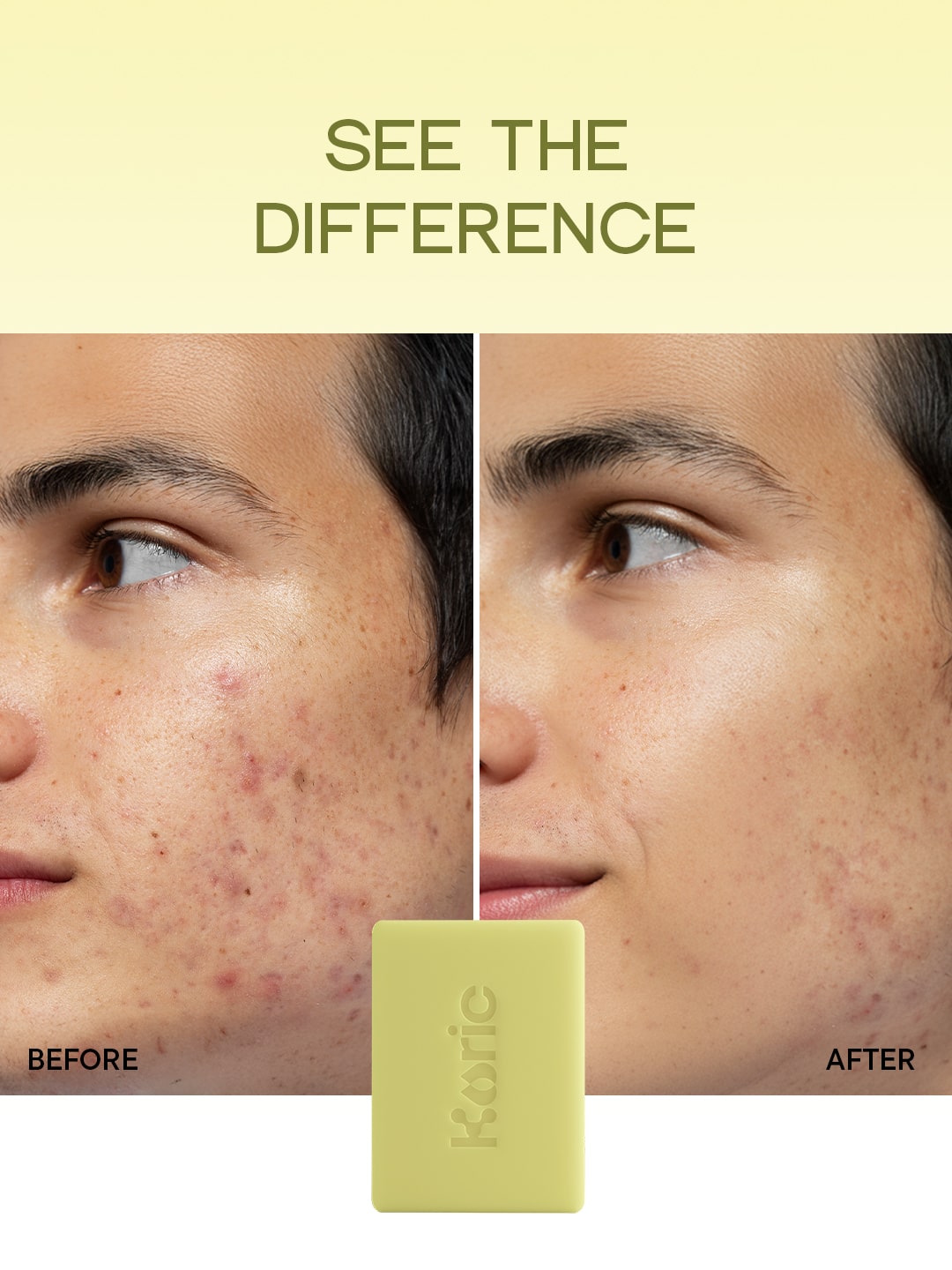 Clarifying + Calming Cleansing Bar