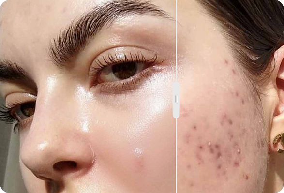 Before / After skin Desktop