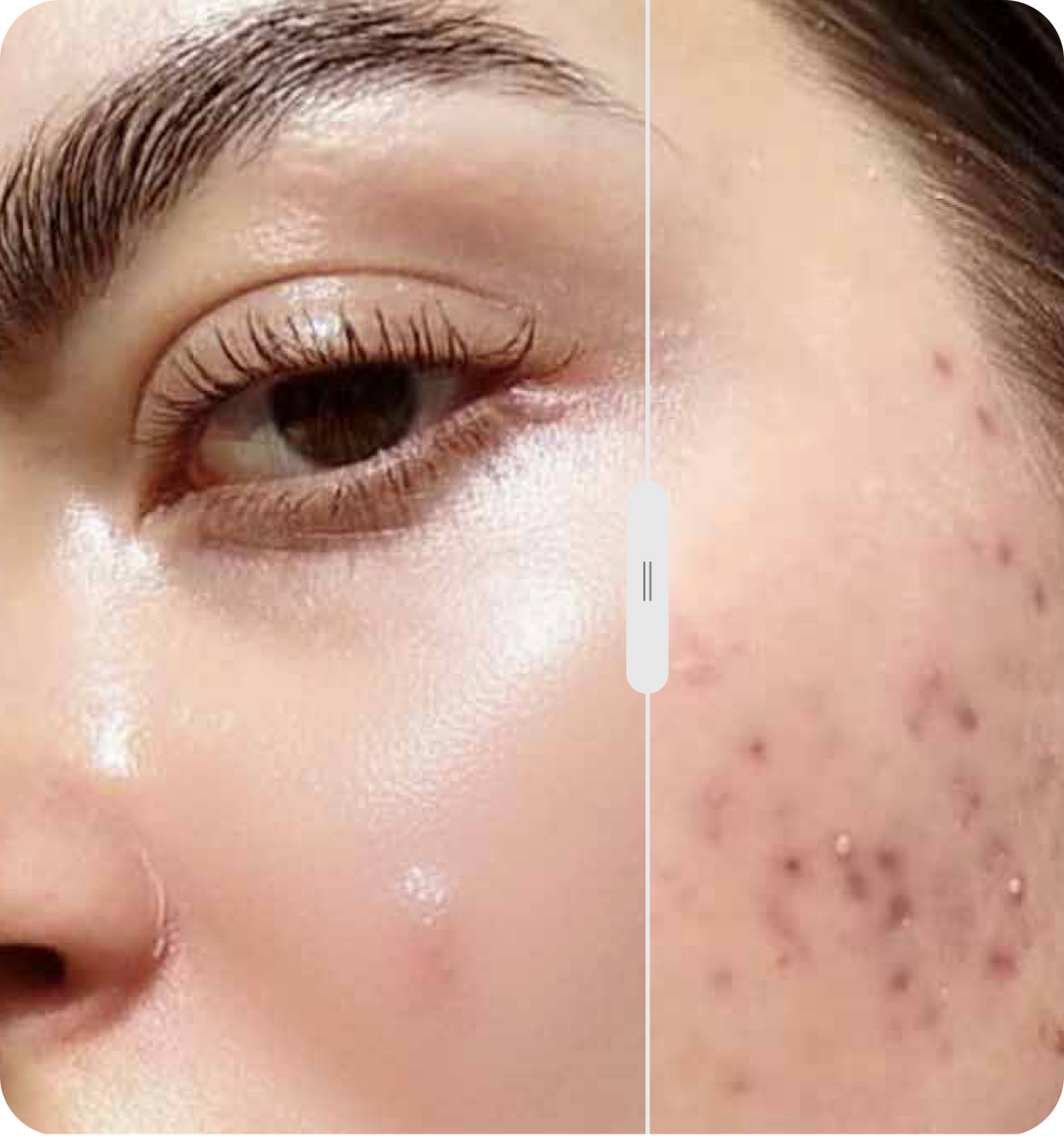 Before / After skin Mobile